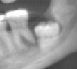 Fig 3 Fig 3