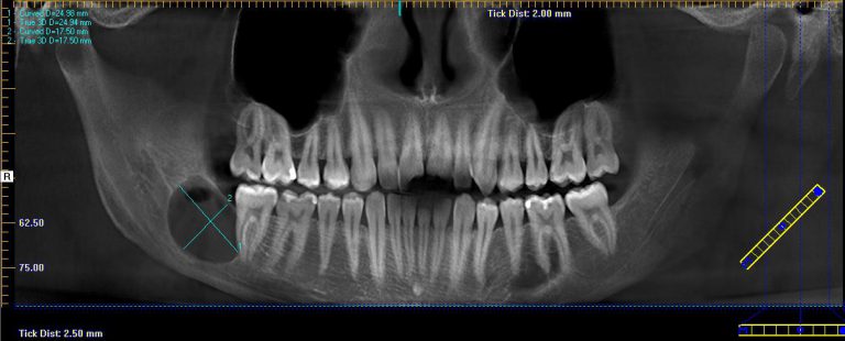 Figure 1a 768x310 1