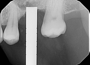 Figure 2 300x216 1 Figure 2 300x216 1