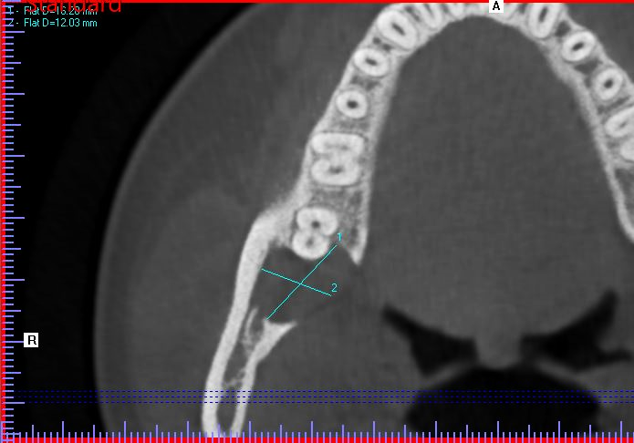 Figure 4b